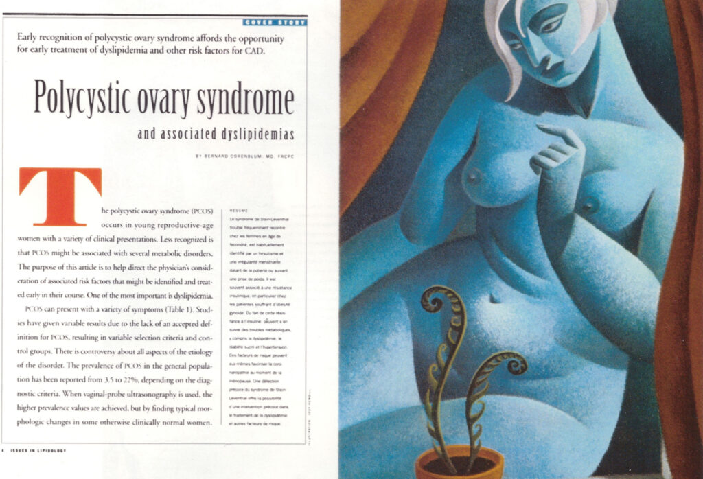 Polycystic Ovarian Syndrome
