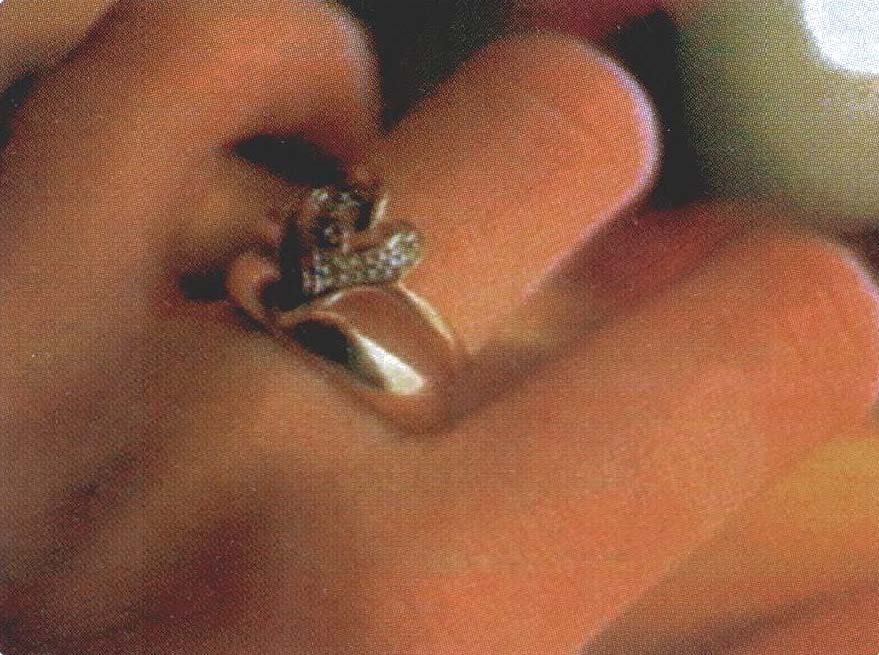 Ring