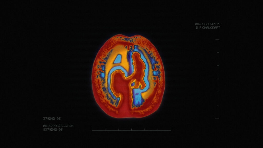 Brain Scan