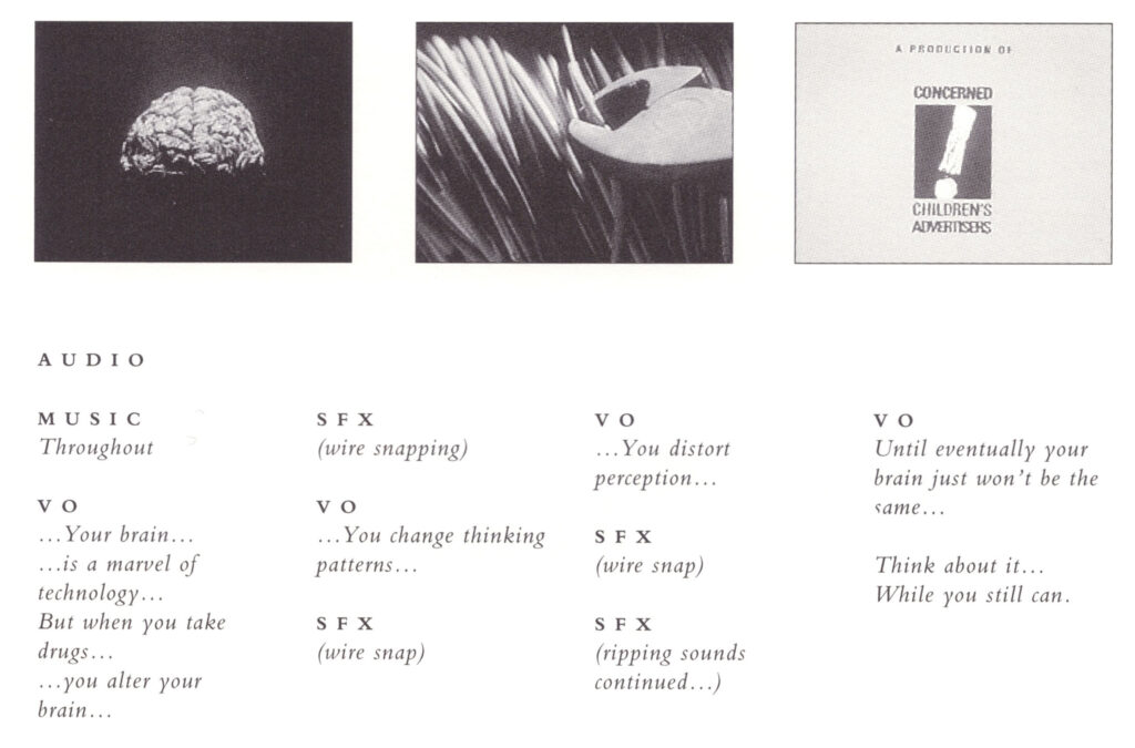 Brain